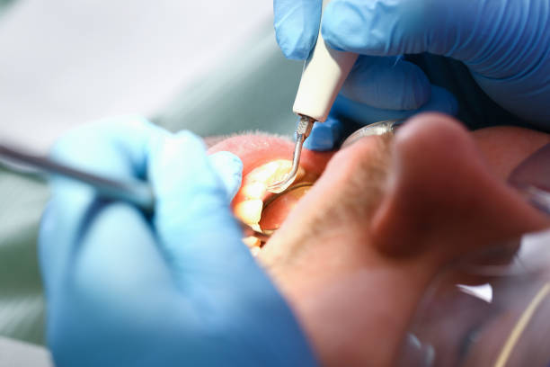 Best Urgent Dental Care for Toothache in Lake Holiday, IN