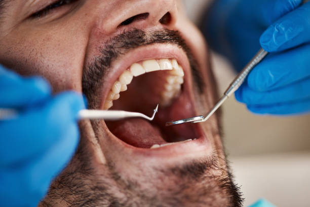 Best Urgent Dental Care for Toothache in Lake Holiday, IN